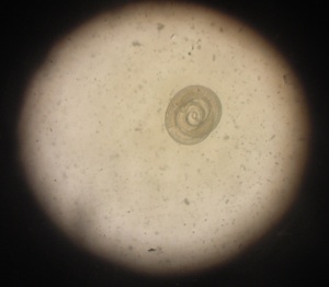 Larva of the roundworm Trichinella viewed through a microscope. Trichinella is the smallest human nematode parasite and people can get infected with its larvae through eating undercooked pork. (photo credit: ILRI/Kristina Roesel).